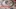 Video Platzhalter Video Platzhalter